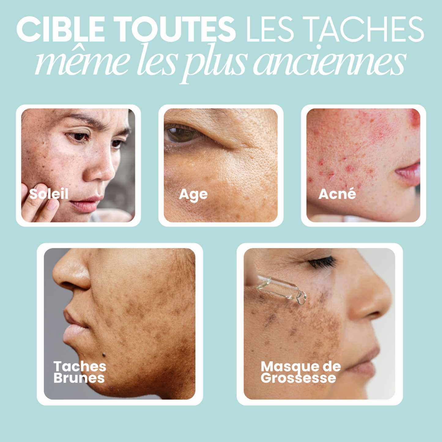 GlowSkin Pure® - Crème Anti-Taches