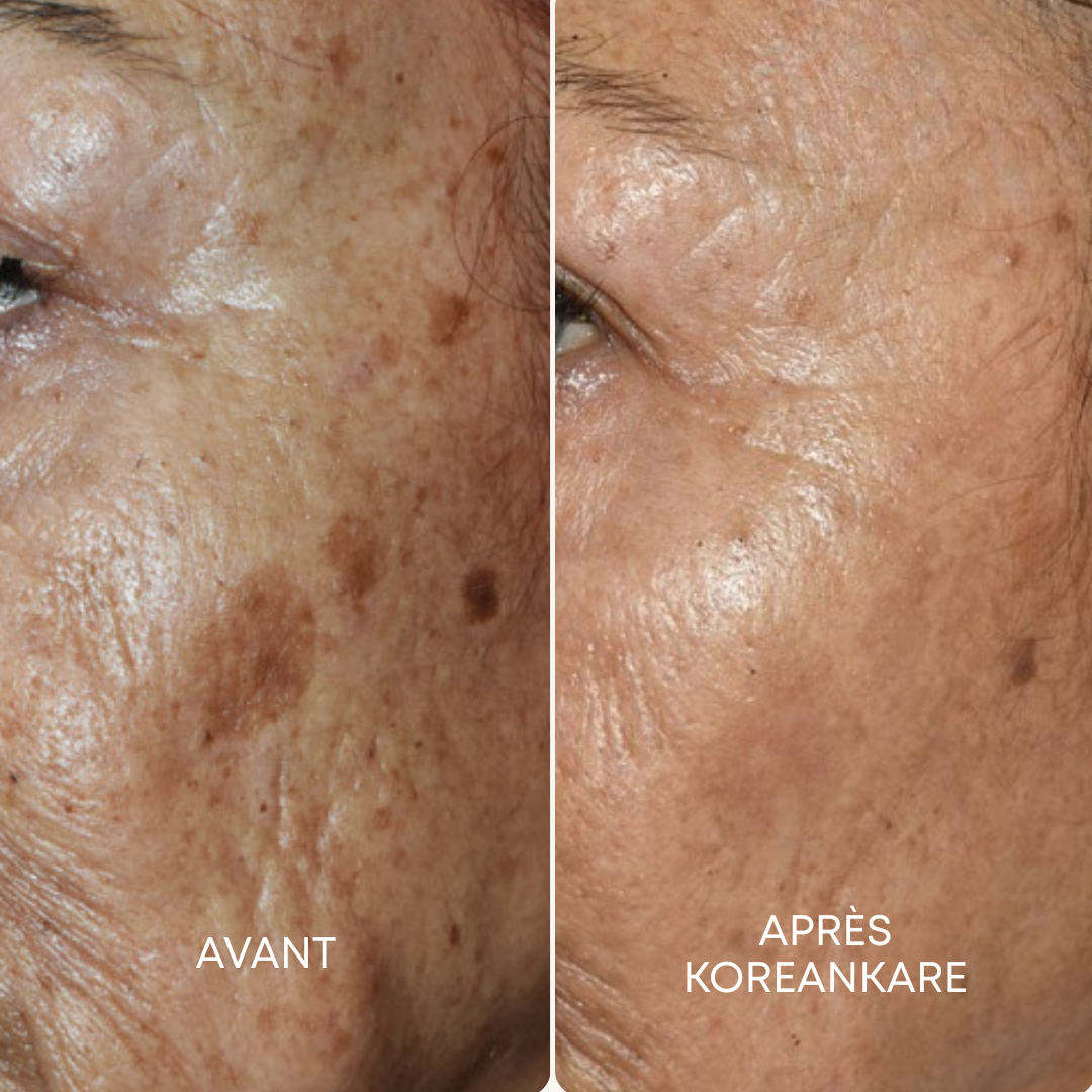 GlowSkin Pure® - Crème Anti-Taches
