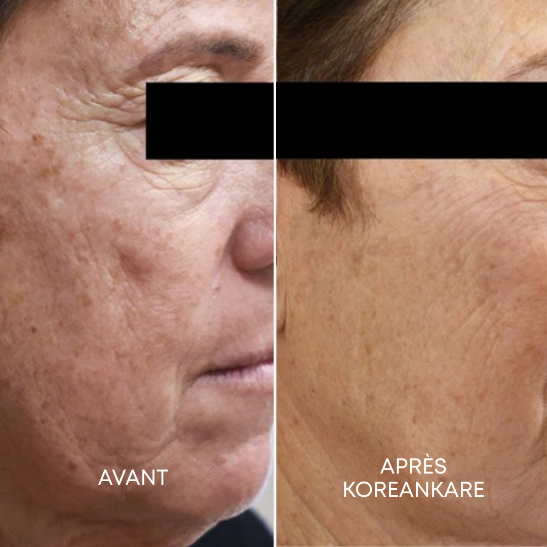 GlowSkin Pure® - Crème Anti-Taches