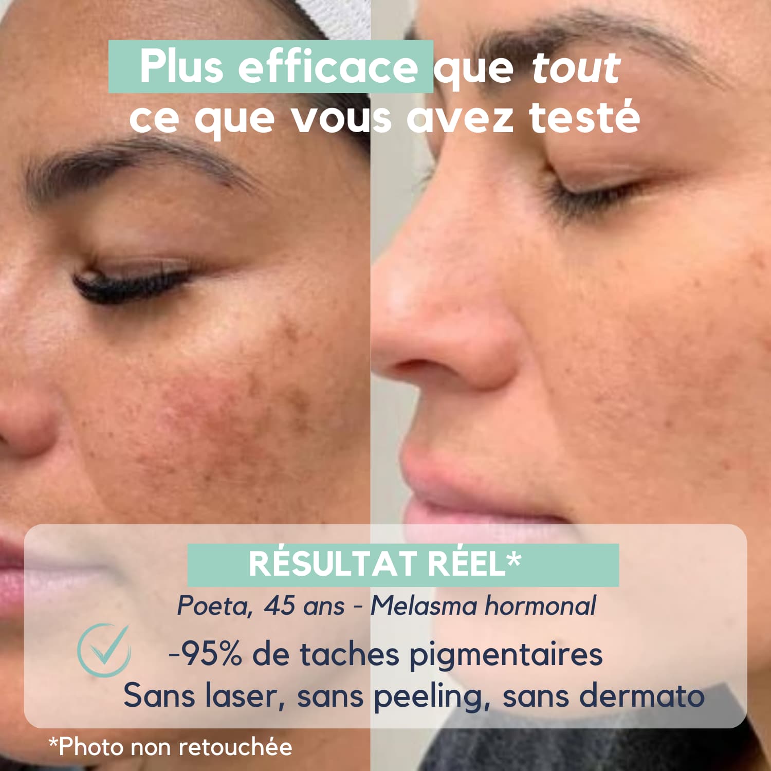 DarkSpot™ – Soin Expert Anti-Taches