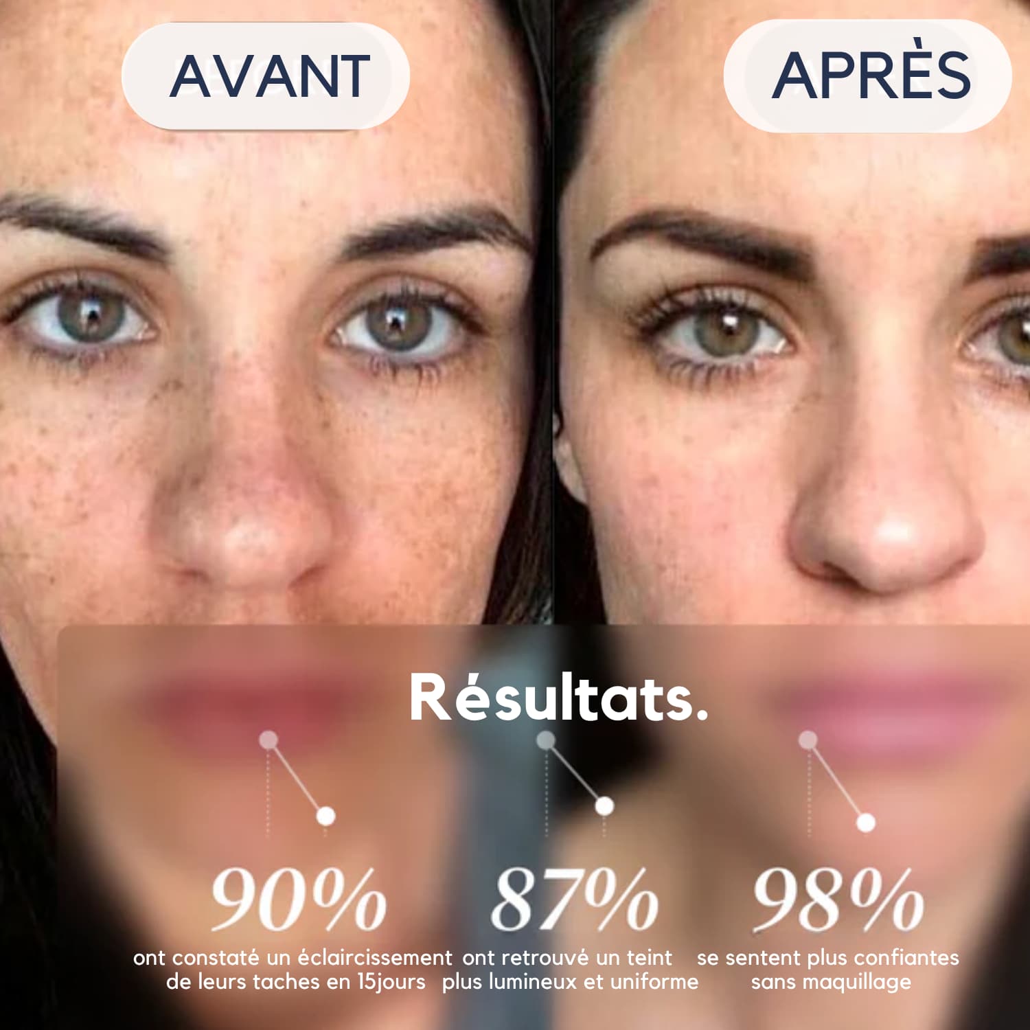 DarkSpot™ – Soin Expert Anti-Taches