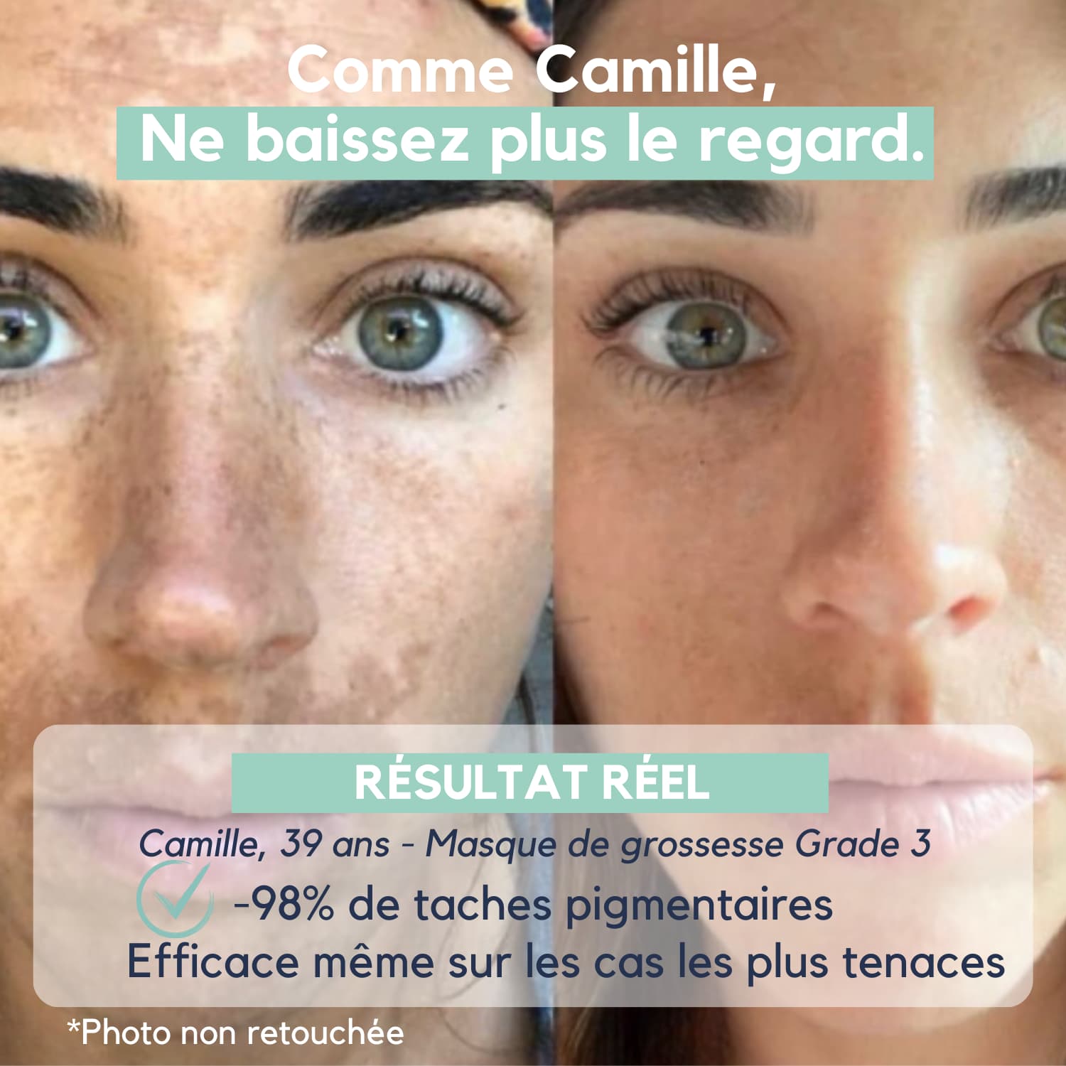 DarkSpot™ – Soin Expert Anti-Taches