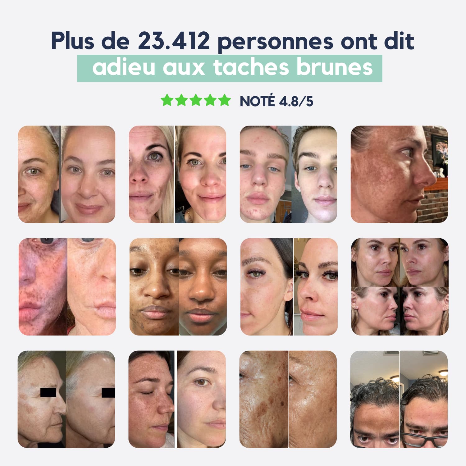 DarkSpot™ – Soin Expert Anti-Taches