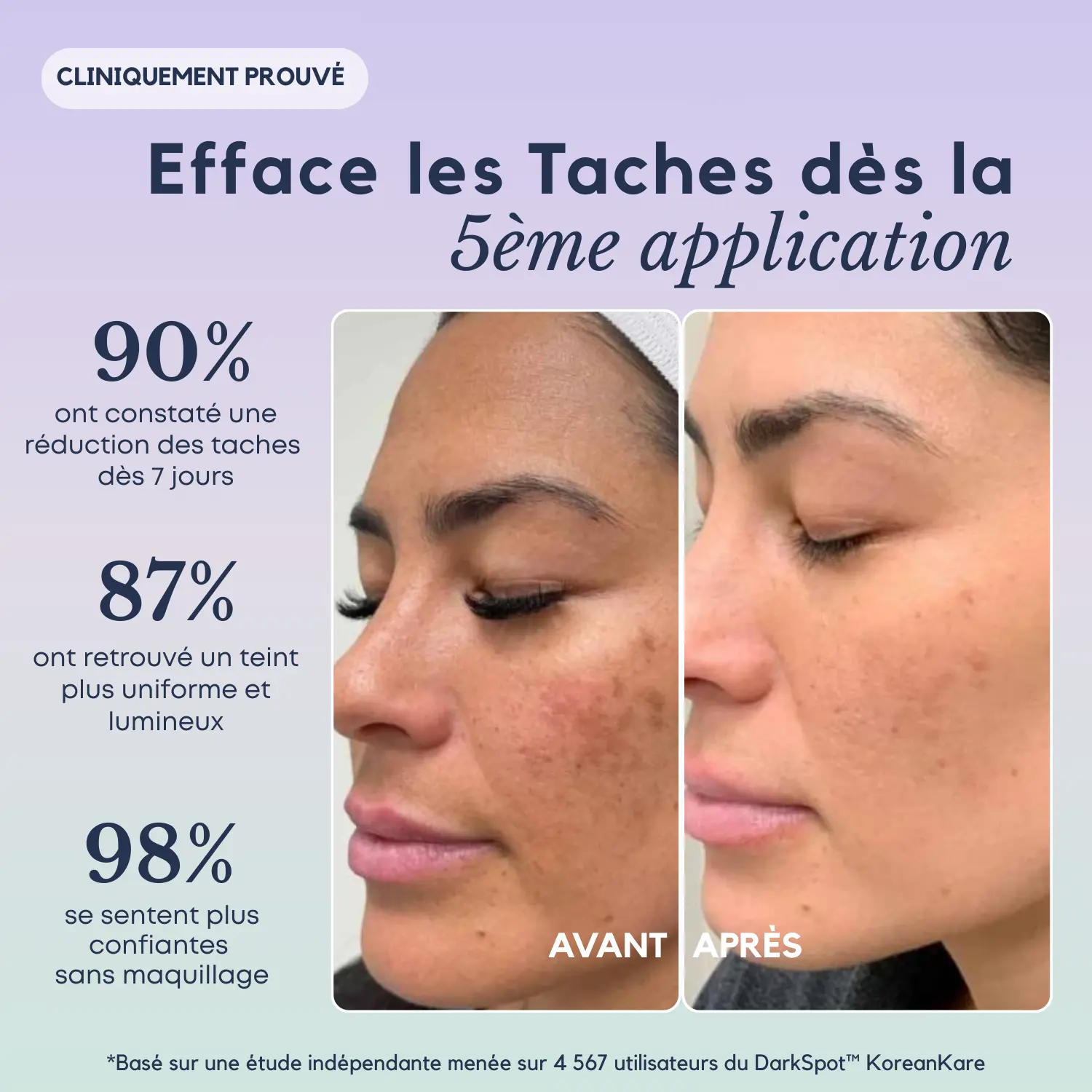 DarkSpot™ - Crème Anti-taches