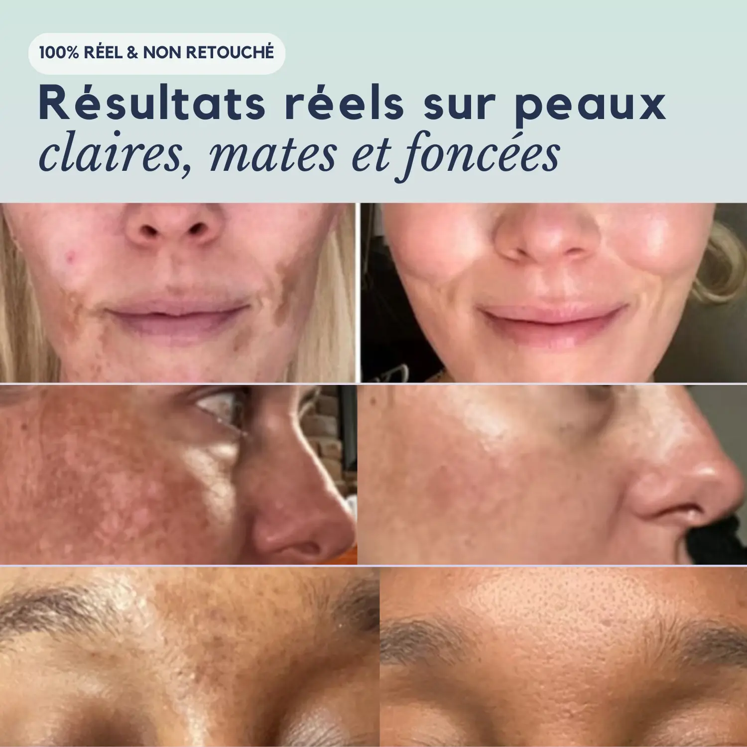 DarkSpot™ - Crème Anti-taches