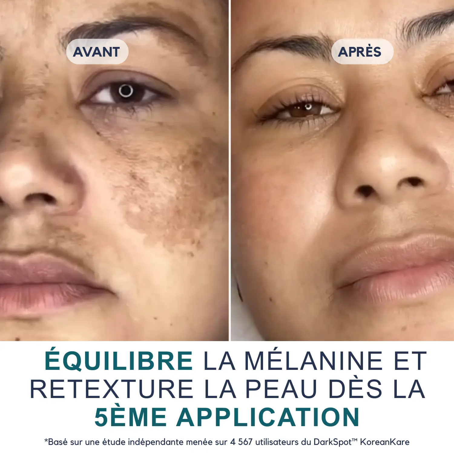 DarkSpot™ - Crème Anti-taches