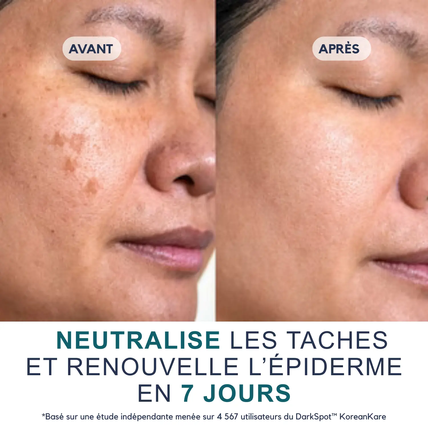 DarkSpot™ - Crème Anti-taches