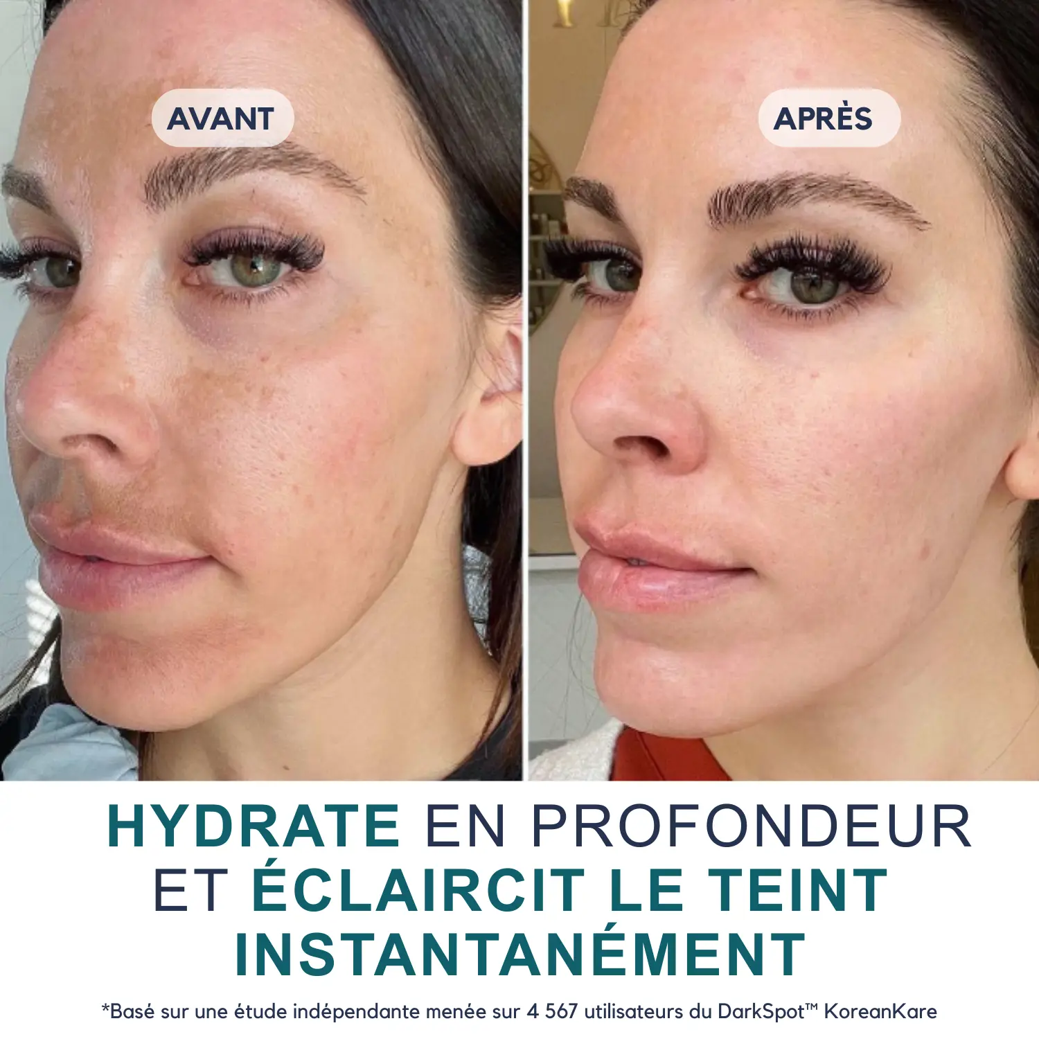 DarkSpot™ - Crème Anti-taches